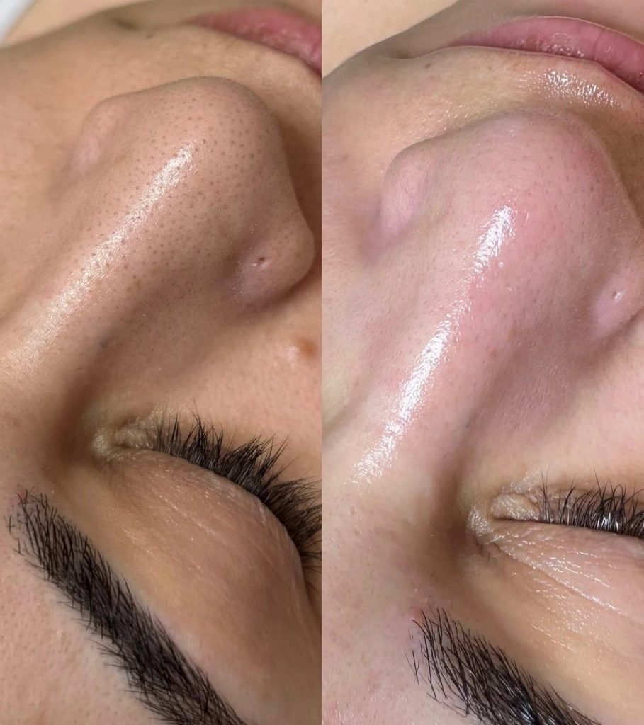 Afc5BUCxFbFZLBVPLl3gpliUrrYsqgE7FP6GlcHtflsMTfAZaDuquFYNXUTfwXjCGZs0KG6JEg9CeSwKAncwFaqf.jpg Afc5BUCxFbFZLBVPLl3gpliUrrYsqgE7FP6GlcHtflsMTfAZaDuquFYNXUTfwXjCGZs0KG6JEg9CeSwKAncwFaqf.jpg